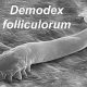 Demodex Mites Linked to Chronic Dry Eye Issues