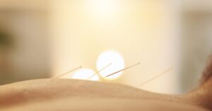 Acupuncture Benefits for Healing and Natural Recovery