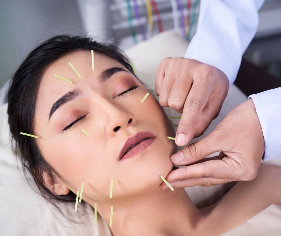 Cosmetic Acupuncture: Key Drawbacks You Should Consider