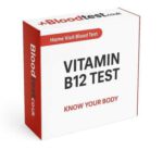 B12 Deficiency Blood Test: Signs and Procedure in Woking